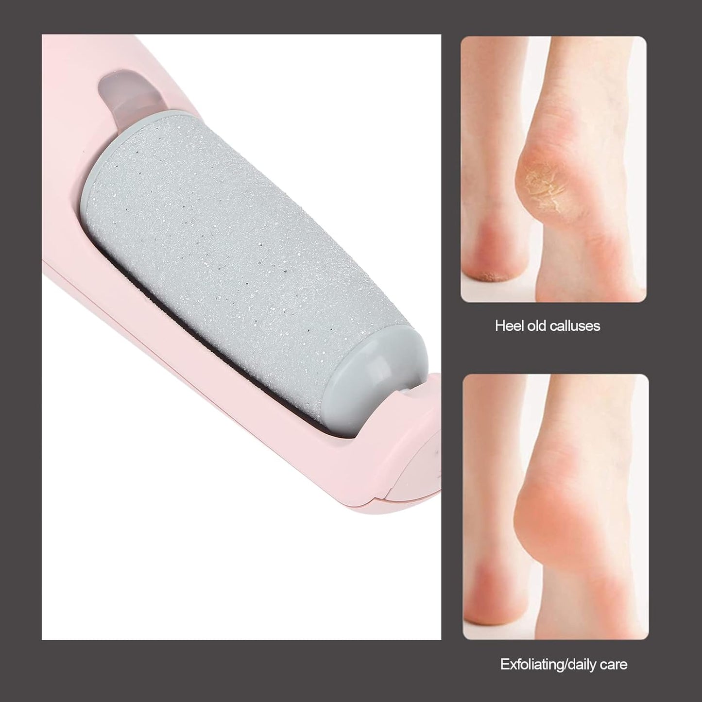 Removedor de Callos Eléctrico - ¡Tu aliado perfecto para una pedicura profesional en casa!